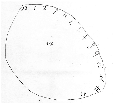 Interpretación del test del reloj en una usuaria con enfermedad de Parkinson