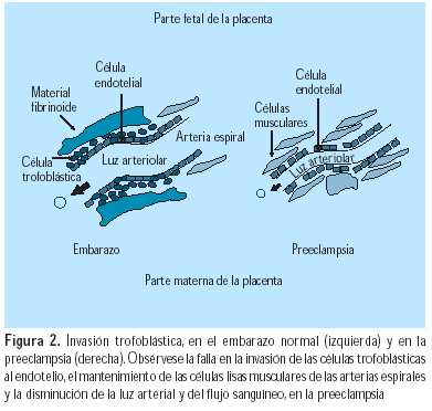 Fisiopatologia Enfermedad Trofoblastica Pdf995