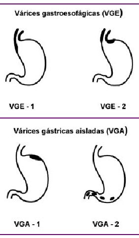 varicoza comprese din miere