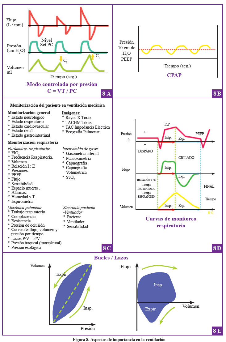 Ventilacion Asistida Proporcional Pdf