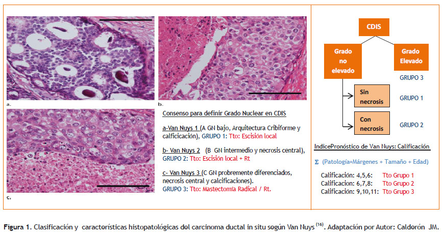 que es cancer in situ