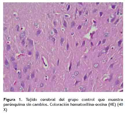 Sulfato ferroso en vidrio de reloj químico con estructura química, un  medicamento utilizado para tratar y prevenir la anemia por deficiencia de  hierro Fotografía de stock - Alamy