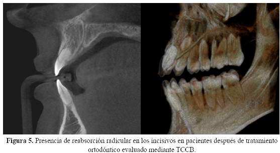 Radiologia-bucal-y-maxilofacial-sotelo-pdf