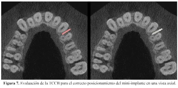 Radiologia-bucal-y-maxilofacial-sotelo-pdf