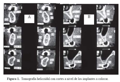 Descripción: C:\SciELO\serial\reh\v25n3\img\revistas\reh\v25n3\a06f1.jpg