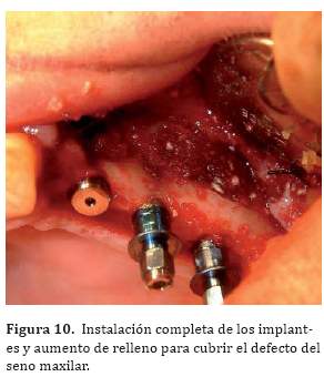 Descripción: C:\SciELO\serial\reh\v25n3\img\revistas\reh\v25n3\a06f10.jpg