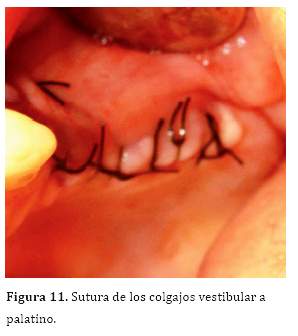 Descripción: C:\SciELO\serial\reh\v25n3\img\revistas\reh\v25n3\a06f11.jpg