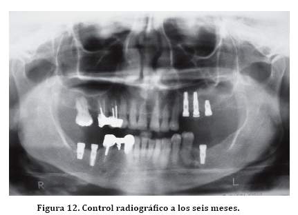 Descripción: C:\SciELO\serial\reh\v25n3\img\revistas\reh\v25n3\a06f12.jpg