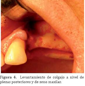 Descripción: C:\SciELO\serial\reh\v25n3\img\revistas\reh\v25n3\a06f4.jpg