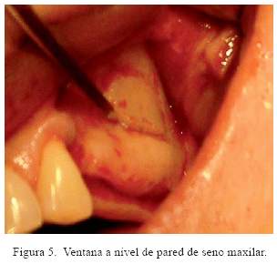 Descripción: C:\SciELO\serial\reh\v25n3\img\revistas\reh\v25n3\a06f5.jpg