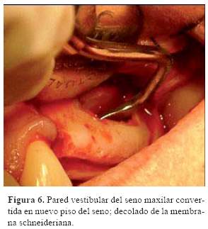 Descripción: C:\SciELO\serial\reh\v25n3\img\revistas\reh\v25n3\a06f6.jpg