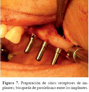 Descripción: C:\SciELO\serial\reh\v25n3\img\revistas\reh\v25n3\a06f7.jpg