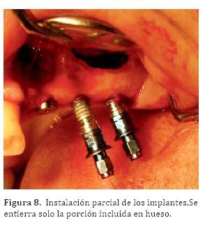 Descripción: C:\SciELO\serial\reh\v25n3\img\revistas\reh\v25n3\a06f8.jpg