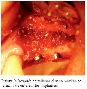 Descripción: C:\SciELO\serial\reh\v25n3\img\revistas\reh\v25n3\a06f9.jpg