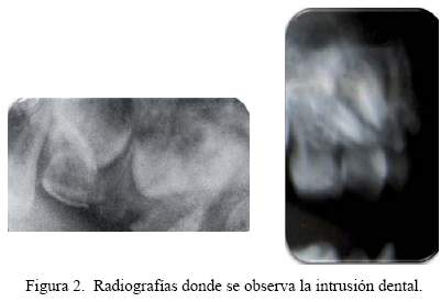 Descripción: C:\SciELO\serial\reh\v25n3\img\revistas\reh\v25n3\a07f2.jpg