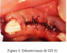 Descripción: C:\SciELO\serial\reh\v25n3\img\revistas\reh\v25n3\a07f4.jpg