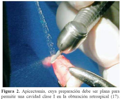 Descripción: Descripción: Descripción: C:\SciELO\serial\reh\v25n3\img\revistas\reh\v25n3\a08f2.jpg