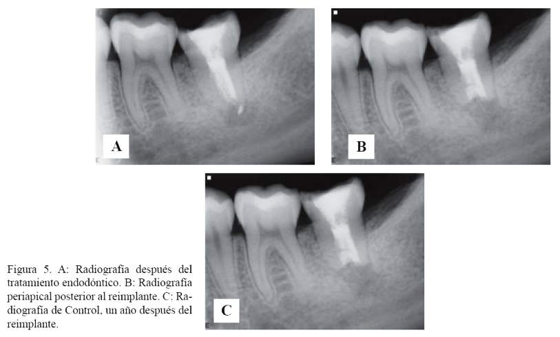 Descripción: Descripción: Descripción: C:\SciELO\serial\reh\v25n3\img\revistas\reh\v25n3\a08f5.jpg