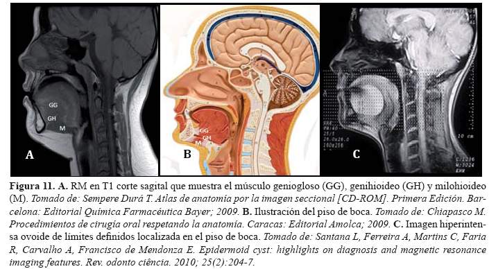 Descripción: Descripción: C:\SciELO\serial\reh\v25n4\img\revistas\reh\v25n4\a09f11.jpg