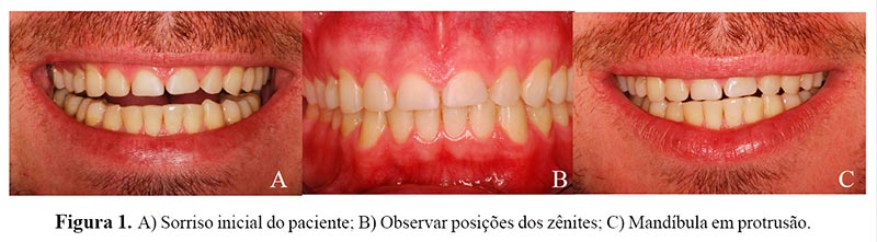 dentistica operatoria mondelli pdf