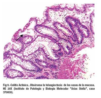 Apendice Histologia