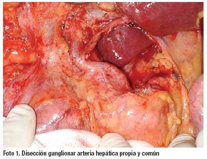 Cancer vesicula biliar sintomas, Traducción de 