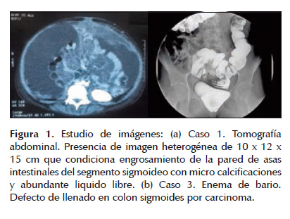 cancer colon ninos sintomas