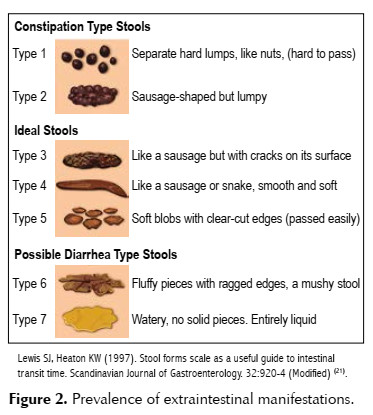 ibs stool shape