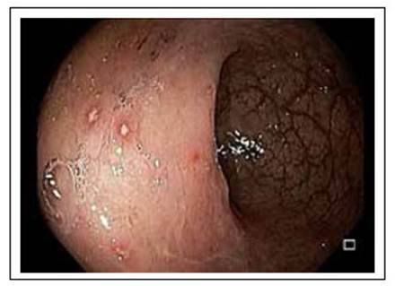Marmanjo chupando buceta molhadinha Bacteria por sexo anal