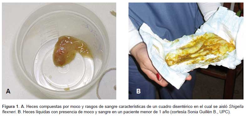 Problemas en el diagnóstico microbiológico en diarrea
