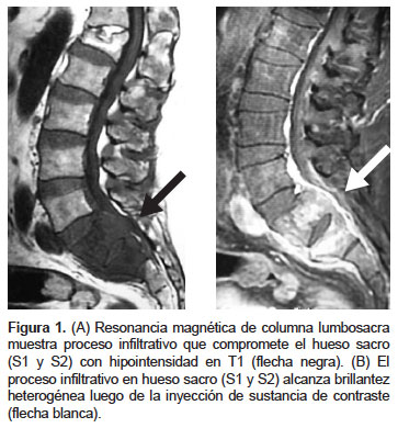 hiperplasia prostatica n40 adenomul de prostata este vindecabil