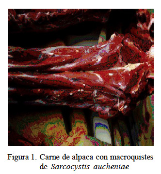 paraziti sarcocistici neuroendocrine cancer of the liver