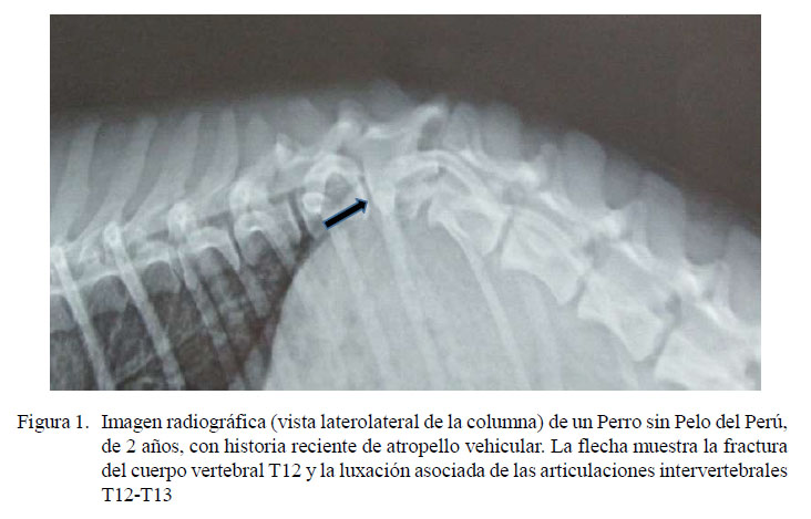 Estabilización quirúrgica la fijación segmentaria con clavo de Steinmann alambre en un canino con luxofractura vertebral toracolumbar