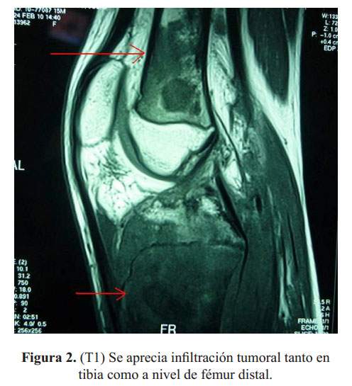 rmn pelvis rmn pelvis