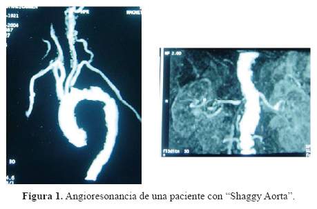 Descripción: Descripción: C:\SciELO\serial\rmh\v26n3\img\revistas\rmh\v26n3\a07f1.jpg