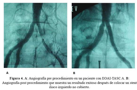 Descripción: Descripción: C:\SciELO\serial\rmh\v26n3\img\revistas\rmh\v26n3\a07f4.jpg