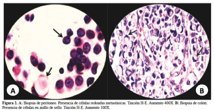 Descripción: C:\SciELO\serial\rmh\v26n3\img\revistas\rmh\v26n3\a09f2.jpg