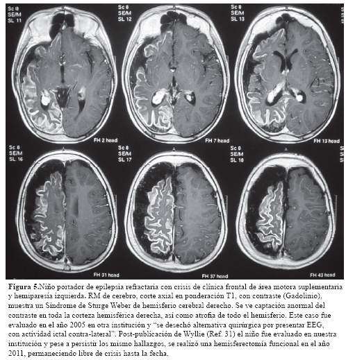 Descripción: C:\SciELO\serial\rnp\v78n3\img\revistas\rnp\v78n3\a03f5.jpg