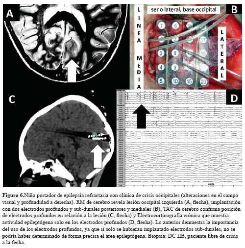 Descripción: C:\SciELO\serial\rnp\v78n3\img\revistas\rnp\v78n3\a03f6.jpg