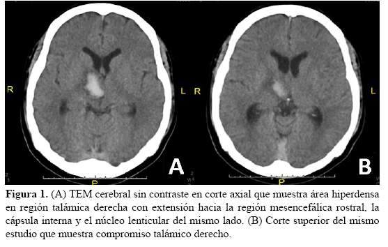 Descripción: C:\SciELO\serial\rnp\v78n3\img\revistas\rnp\v78n3\a07f1.jpg