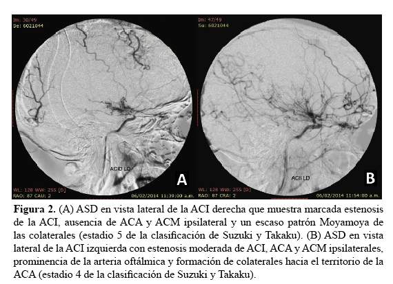 Descripción: C:\SciELO\serial\rnp\v78n3\img\revistas\rnp\v78n3\a07f2.jpg