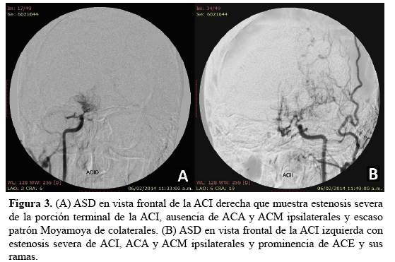 Descripción: C:\SciELO\serial\rnp\v78n3\img\revistas\rnp\v78n3\a07f3.jpg