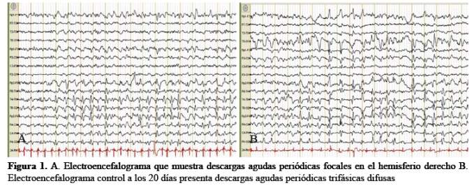 Descripción: C:\SciELO\serial\rnp\v78n3\img\revistas\rnp\v78n3\a08f1.jpg