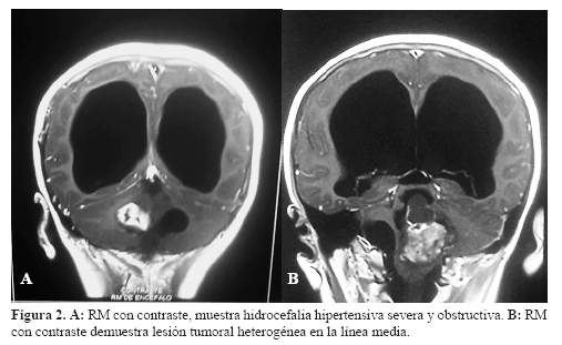 Descripción: Descripción: C:\SciELO\serial\rnp\v78n4\img\revistas\rnp\v78n4\a08f2.jpg