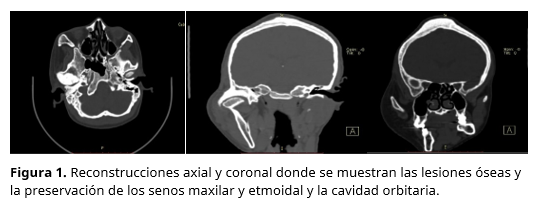 https://revistas.upch.edu.pe/public/site/images/ronaldcallapina/mceclip8.png